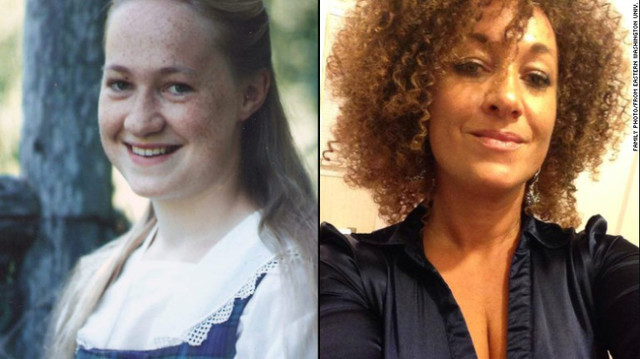 dolezal