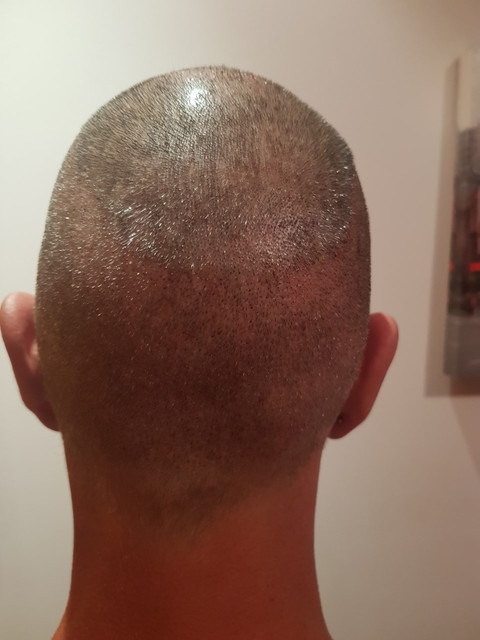 5DIAS2