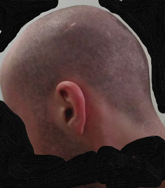 lado 2
