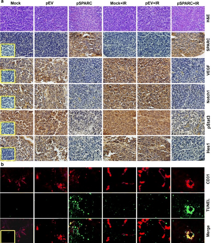 Notch signaling regulates tumor-induced angiogenesis in SPARC-overexpressed neuroblastoma