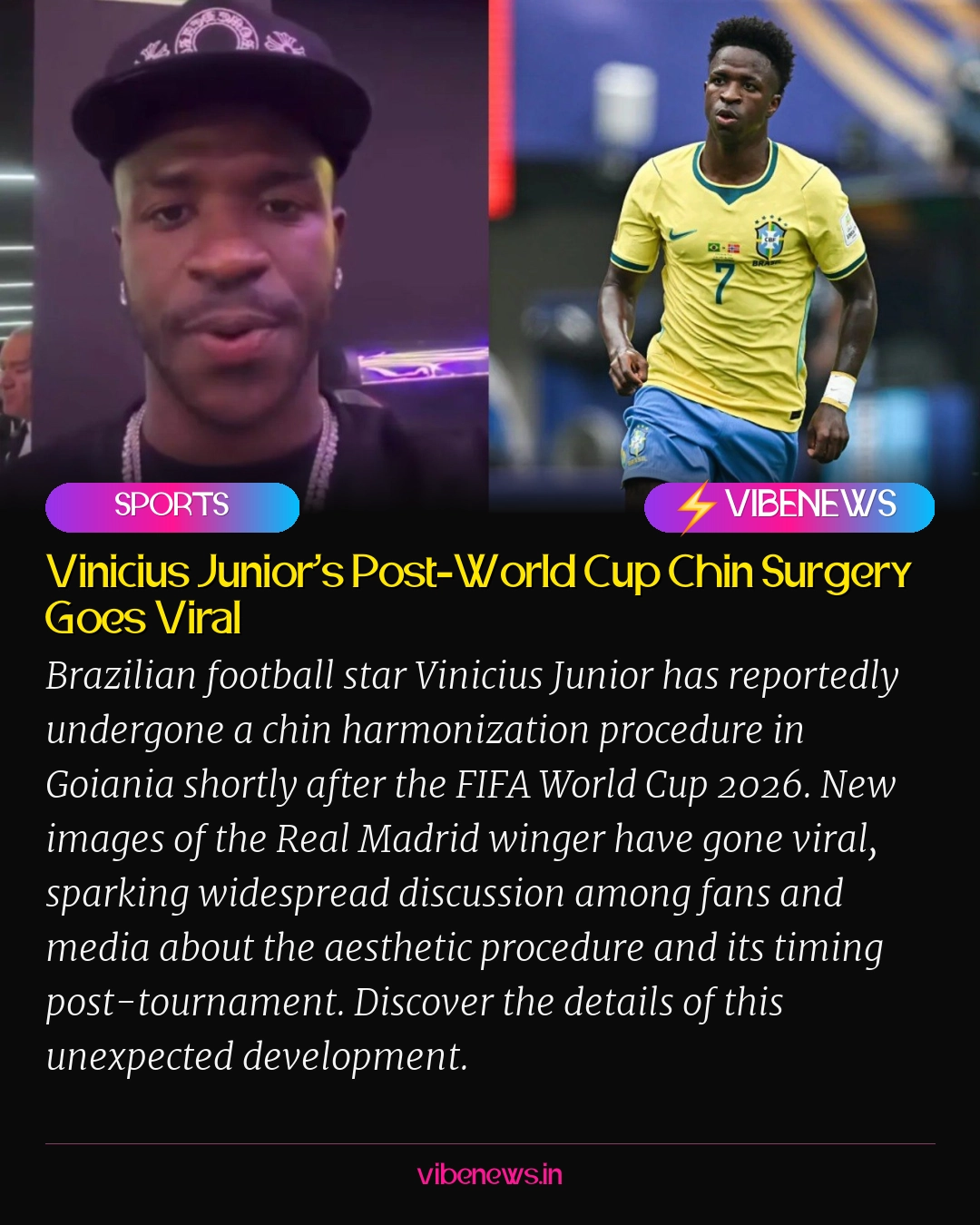 Vinicius Junior’s Post-World Cup Chin Surgery Goes Viral