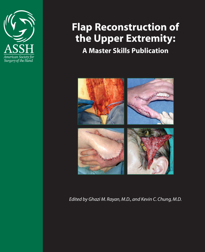 Flap Reconstruction of the Upper Extremity cover