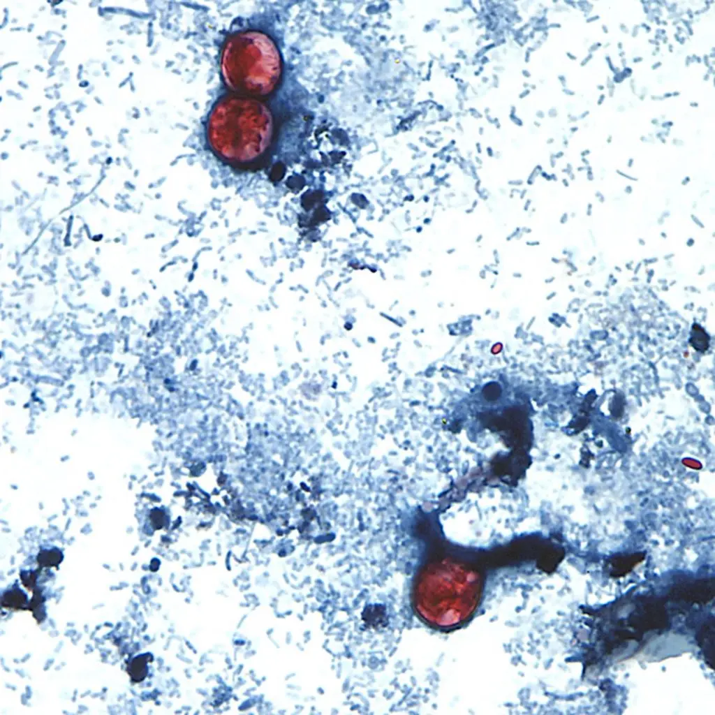 Mystery Deepens in Multi-State Cyclosporiasis Outbreak