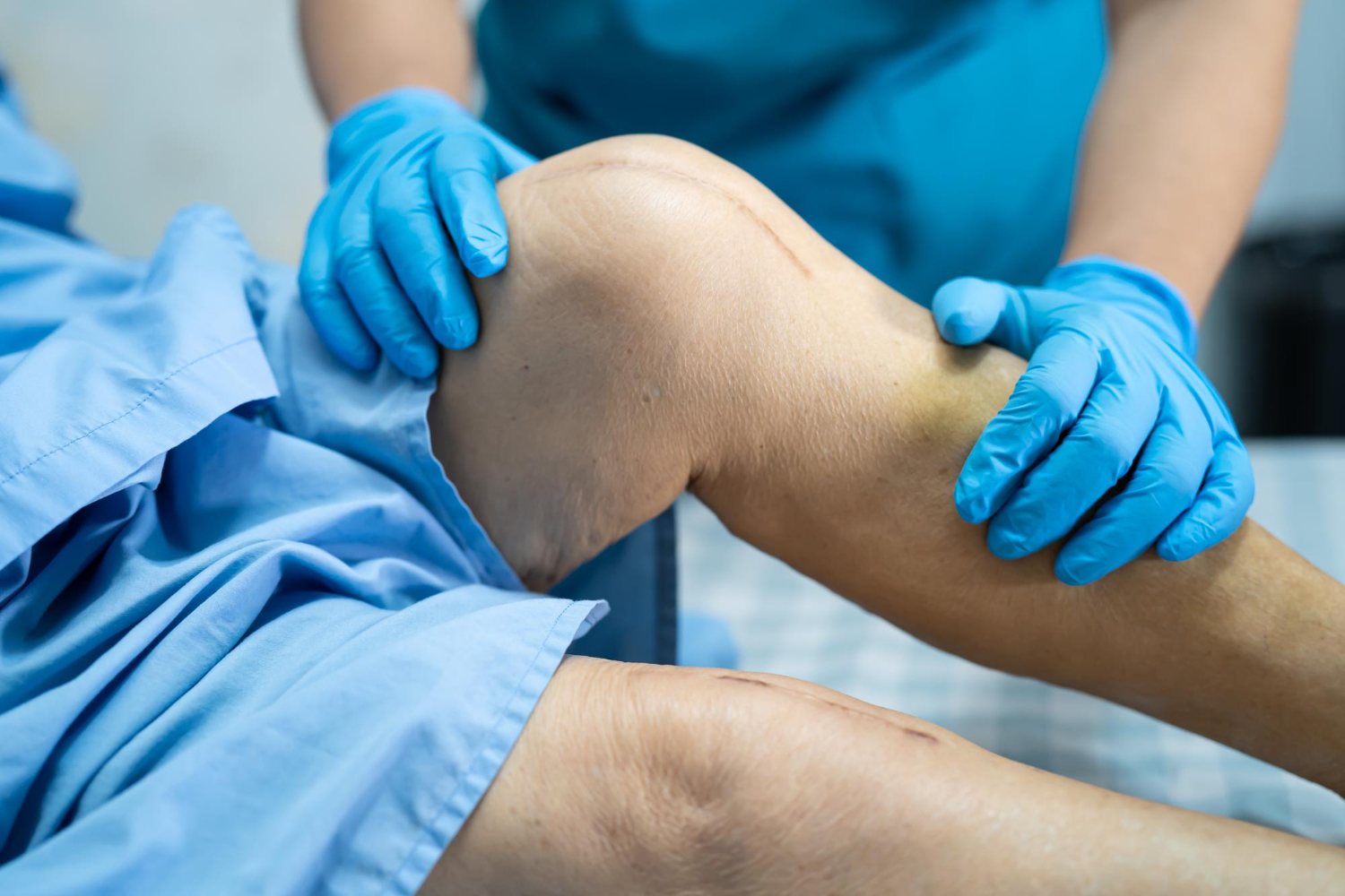 knee checkup