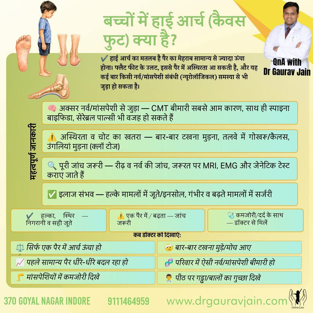 बच्चों में हाई आर्च (कैवस फुट): कारण, लक्षण और इलाज