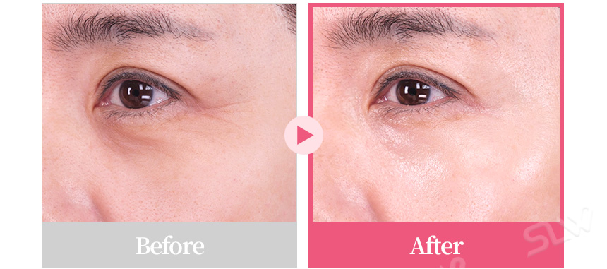 MELACOLLAGENEYECREAM 04