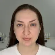Лоб после