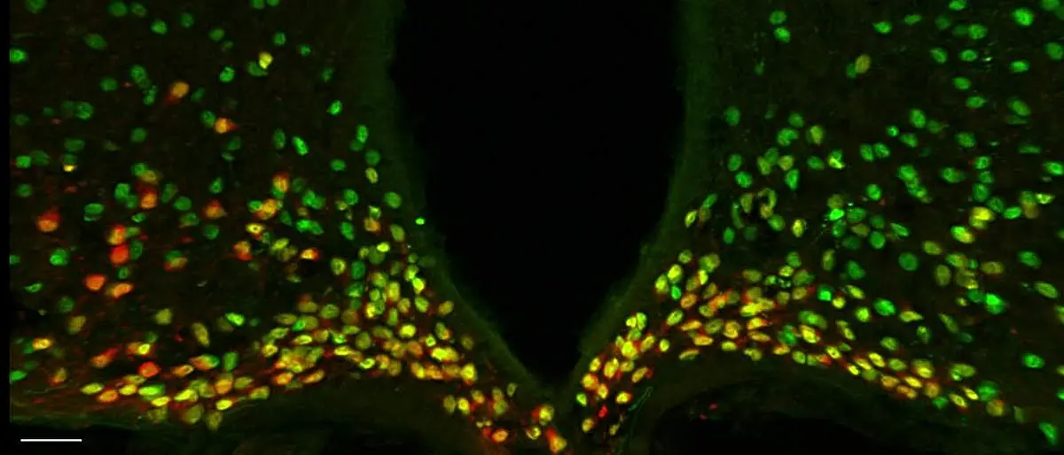 Gene Controls Appetite and Metabolism