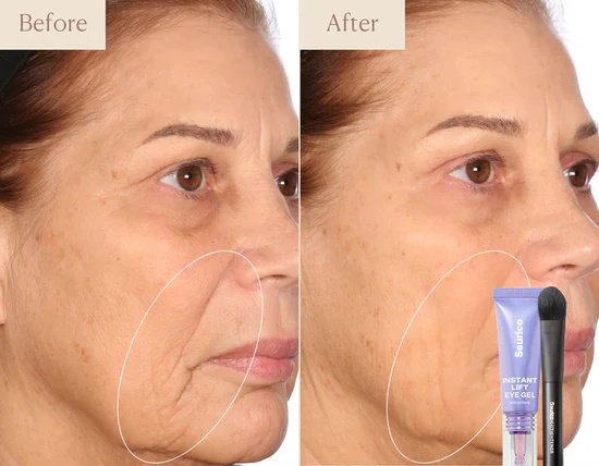 Before and after eye gel result 2
