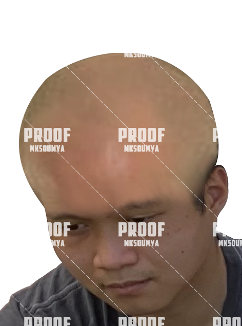 1bald.png