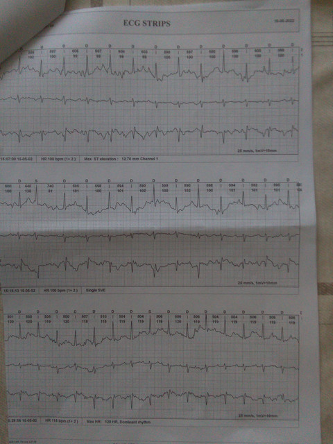 EKG-6