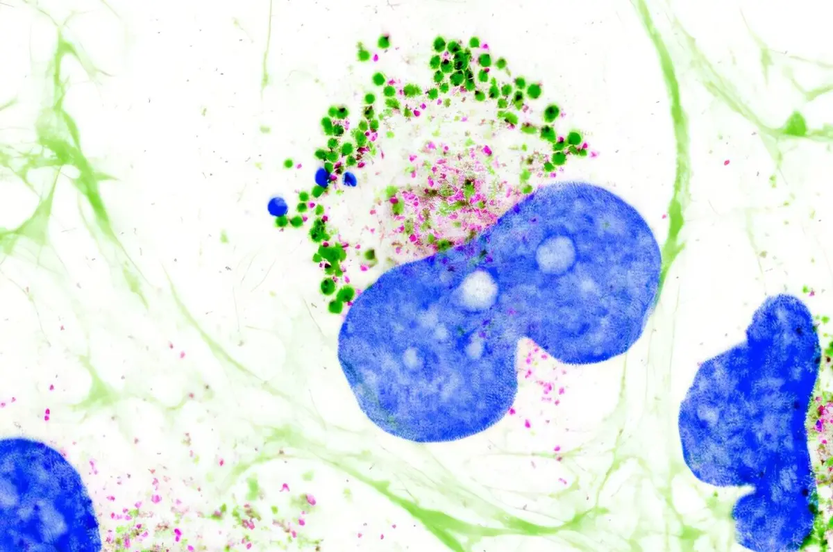 Collagen Found to be Liquid-Like Inside Cells