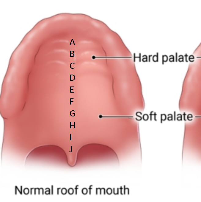 Upper Tip Tongue tip on upper palate - where fore or aft do you put it? : r/taijiquan