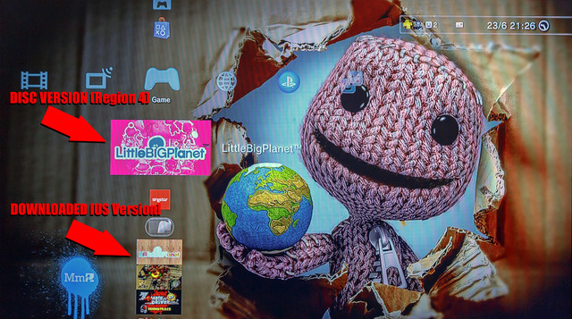 LBP