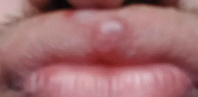 20241114-010401