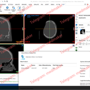Materialise Mimics Core Medical 28 0