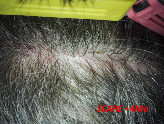 Scare-4mo-2.jpg