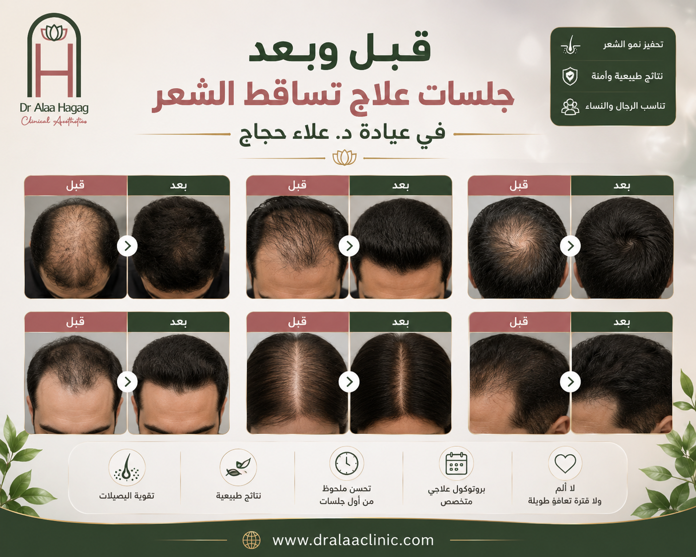 د. علاء حجاج أثناء تقييم وعلاج حالة تساقط الشعر بتقنية الاكسوزوم