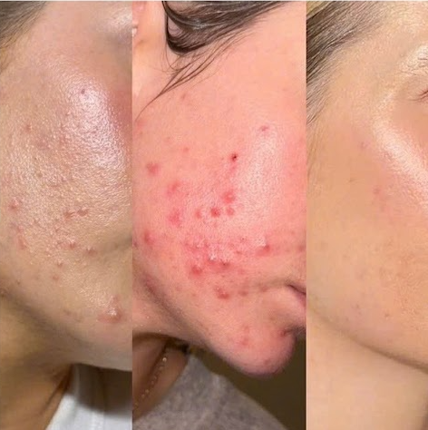 DIVA Skin Clinic Poipet