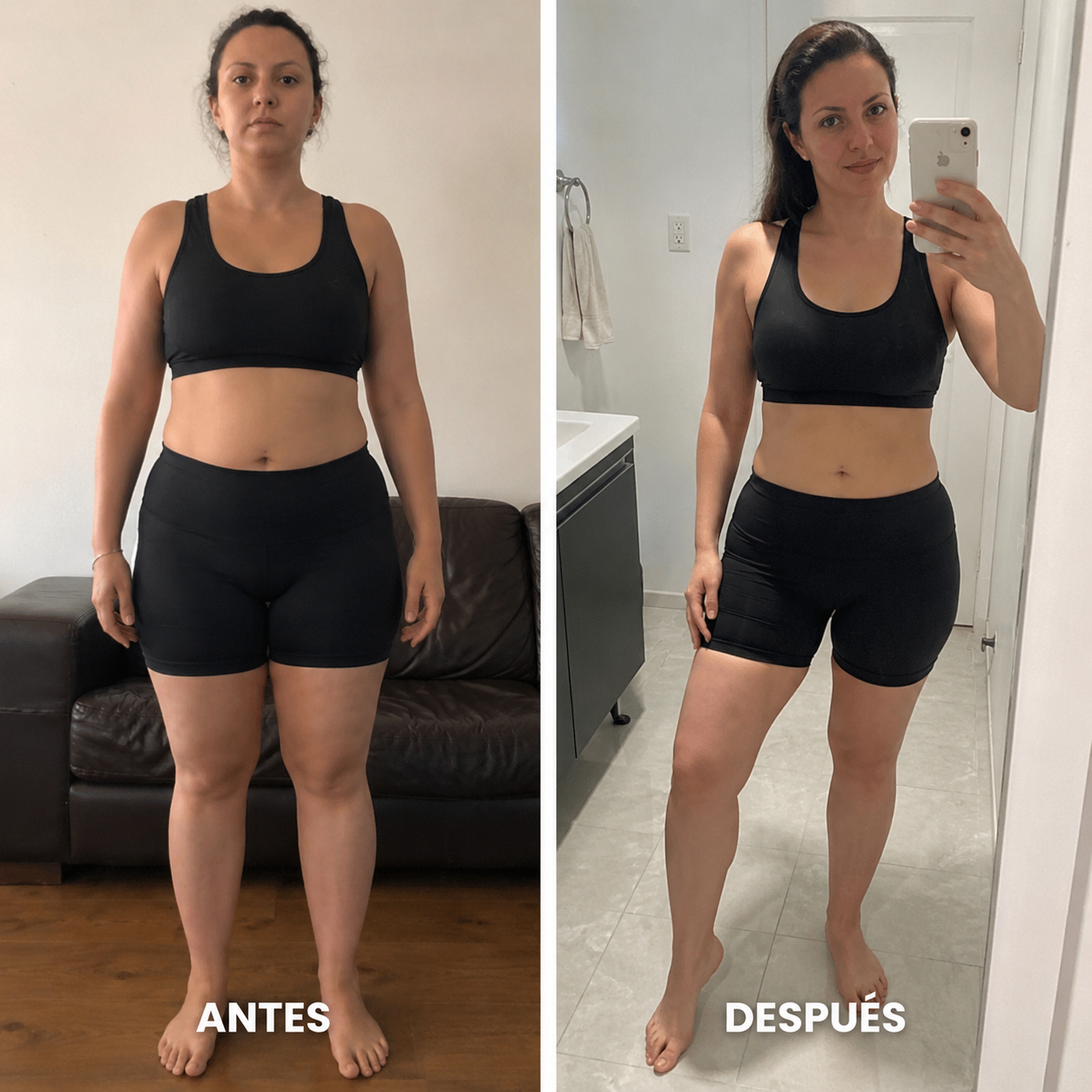 Antes y después bikini — celulitis en muslos