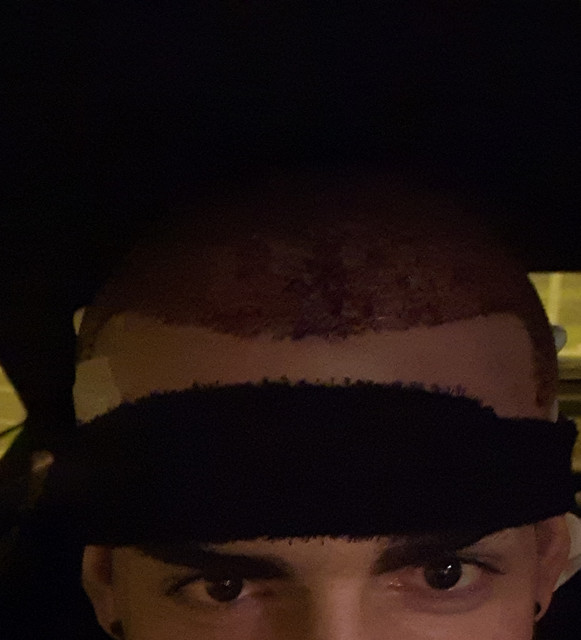 Post operatorio