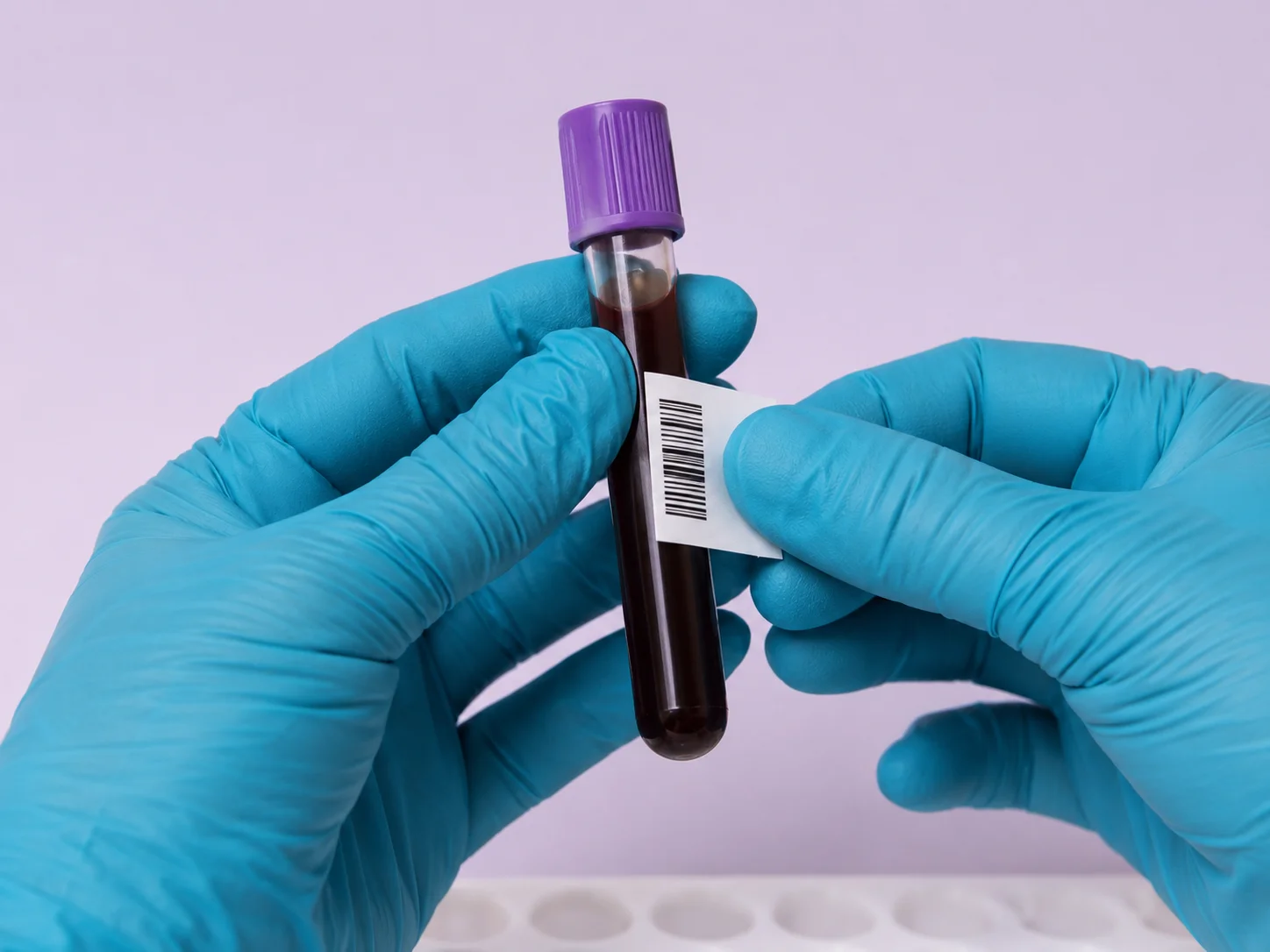 Toma de muestra en laboratorio