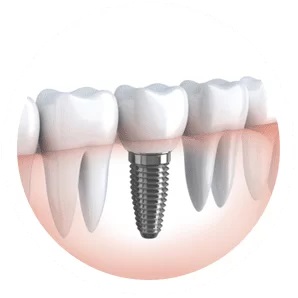 Dr Paulo Pinho Oral Surgery Clinic