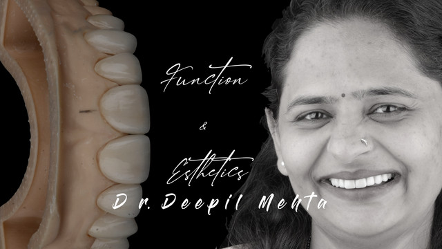Veneer Case 4