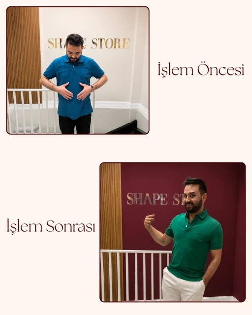 G5 Öncesi Sonrası 11