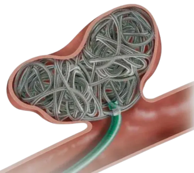 MICROPLEX
