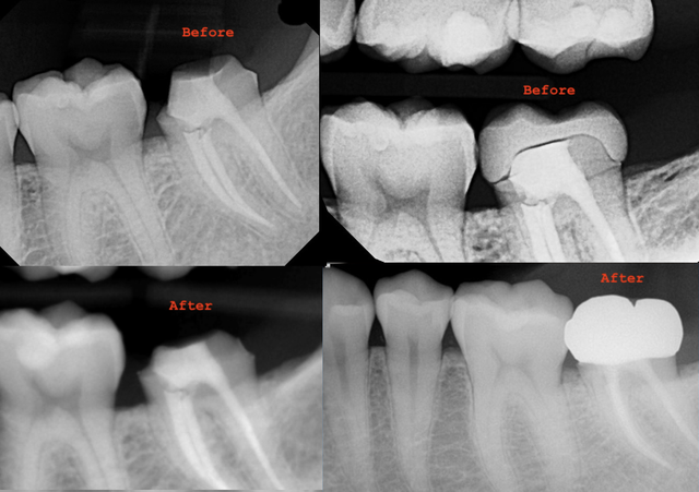 dental shit