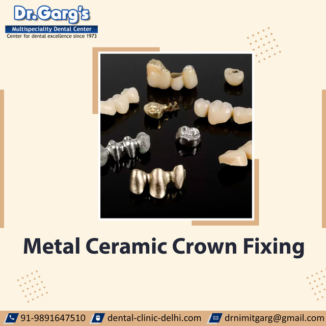 The metal ceramic crown fixing by a specialist dentist is the best way to restore the shape, size and strength of broken or weakened teeth. Dr. Garg’s Multispeciality Dental Centre has dedicated dentists with years of experience in fixing porcelain fused metal dental crowns.

https://dental-clinic-delhi.com/metal-ceramic-crowns

#metalceramiccrown #dentalcrownmetalceramic #metalfreecrown #metalfreeceramics #metalcrown