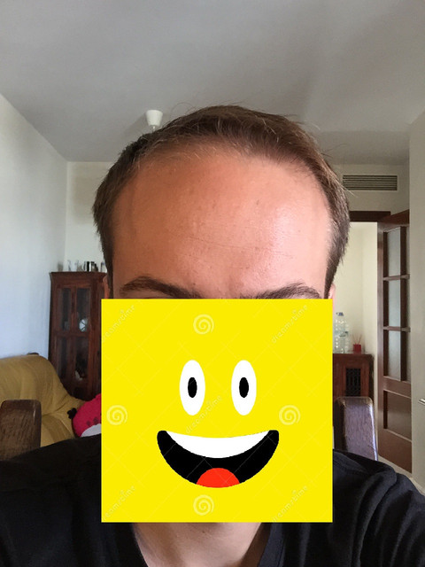 pre-2-d