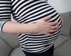 Maternity Review Falls Short on Systemic Racism