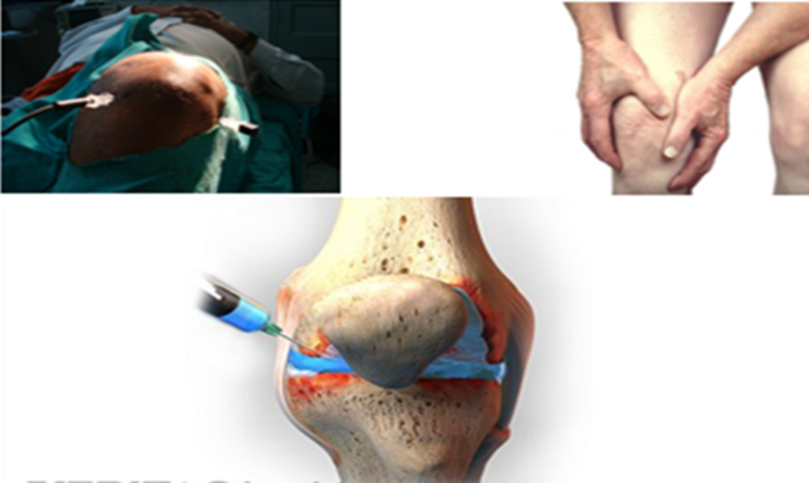 C-Arm Guidance