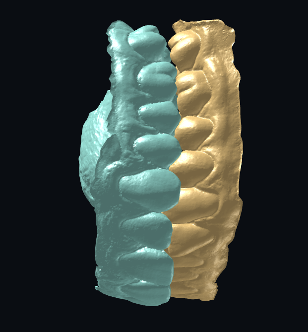 occlusion 5.png