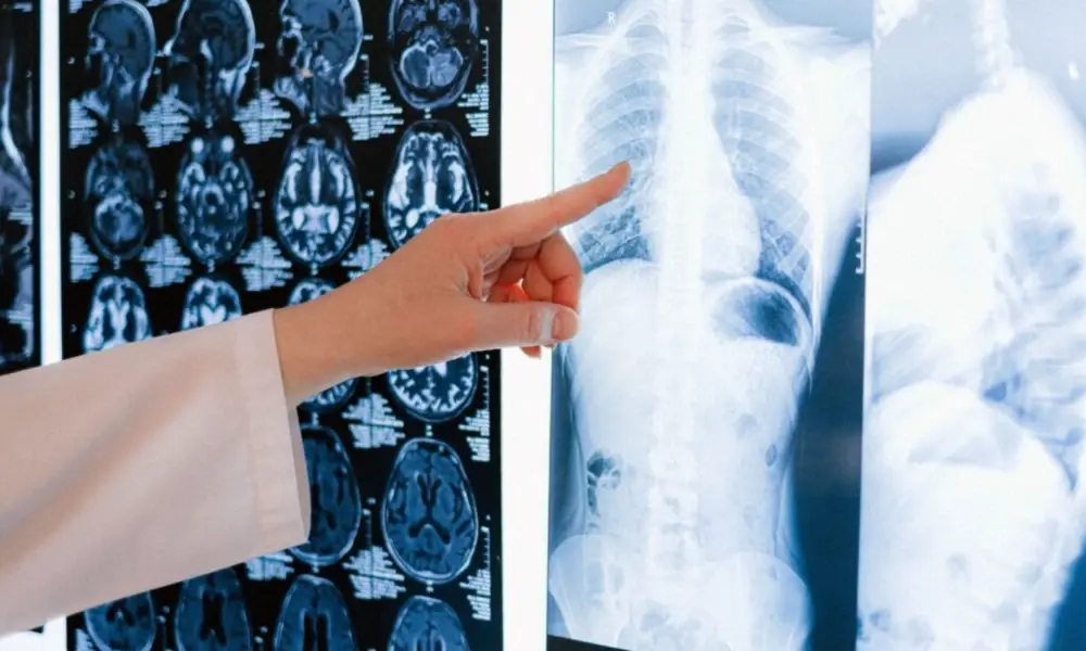 The Silent Threat: Why Early Health Screenings Are Crucial