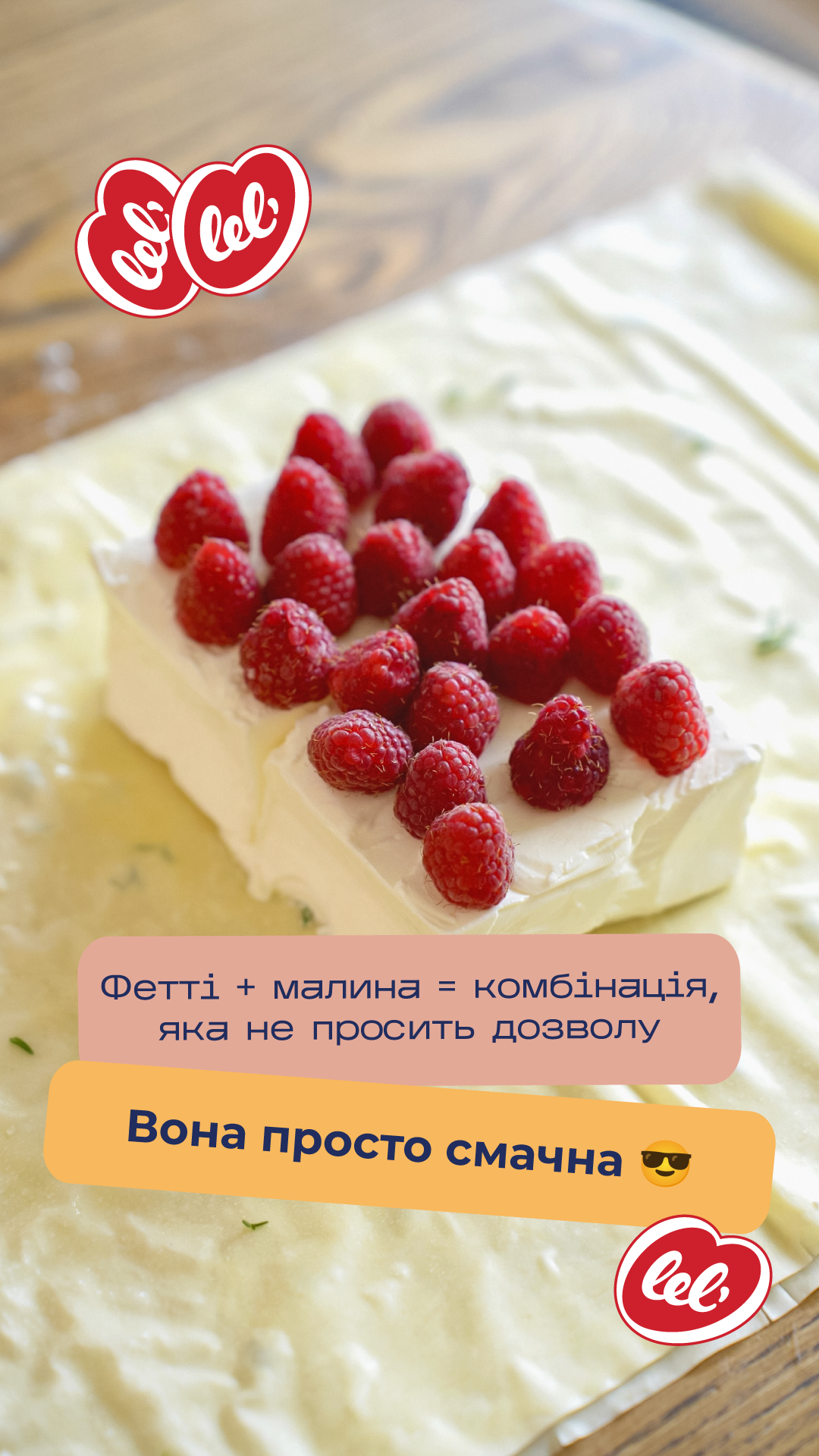 сториз