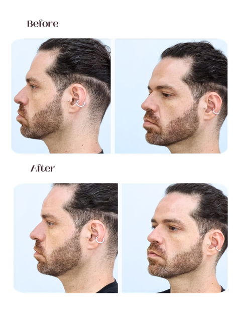 Masculina - Perfil
