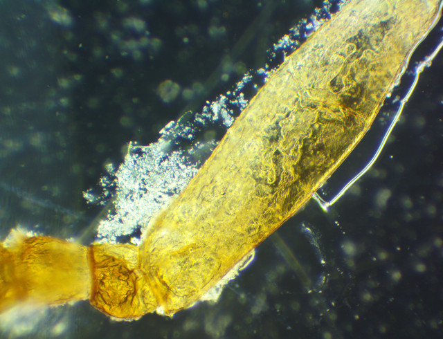 Microcetus Rappi New from Italy - MicrobeHunter.com Microscopy Forum