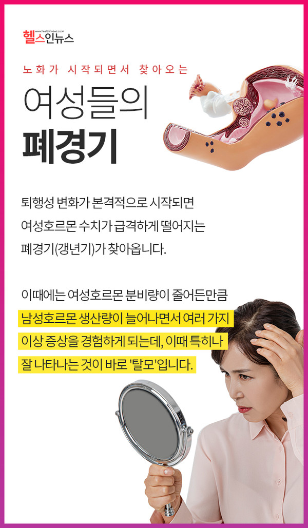 폐경기 호르몬 수치 변화