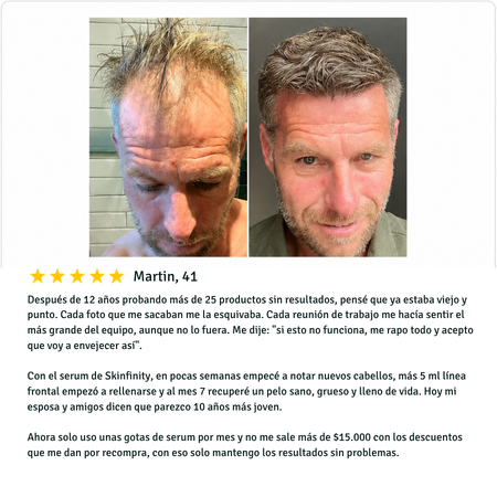 Antes y despu&eacute;s de cliente Skinfinity