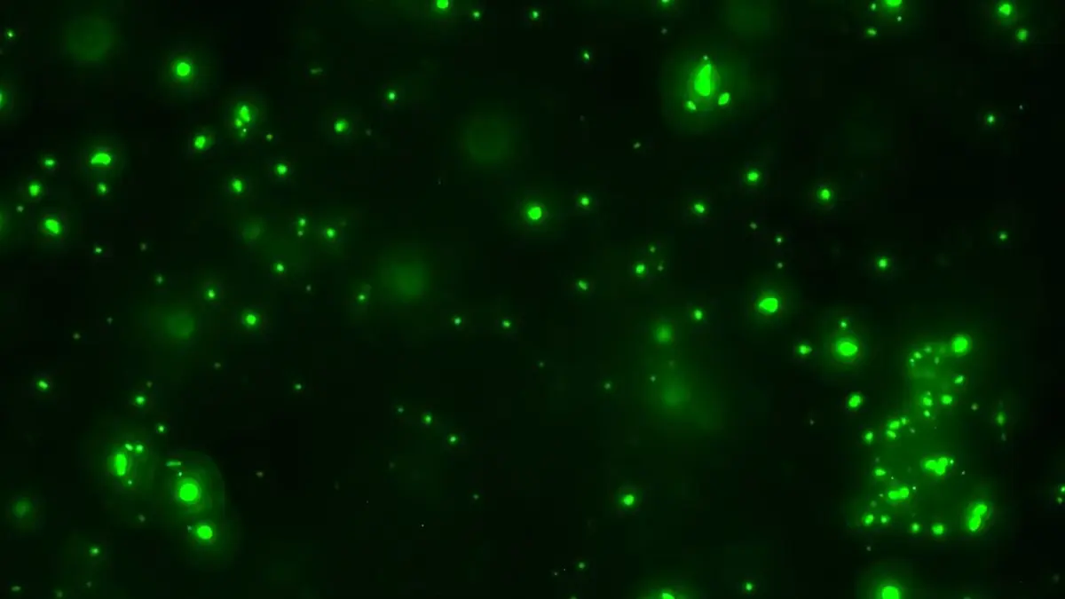 Brain Waste Accumulation & Neuron Health