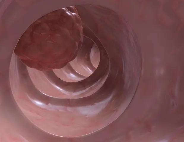 Stimulating Immune Defenses Against Tumors