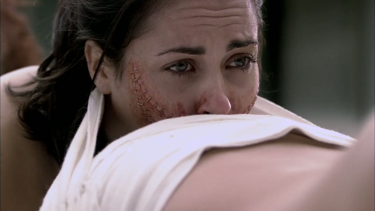 The Human Centipede (First Sequence) Screenshot