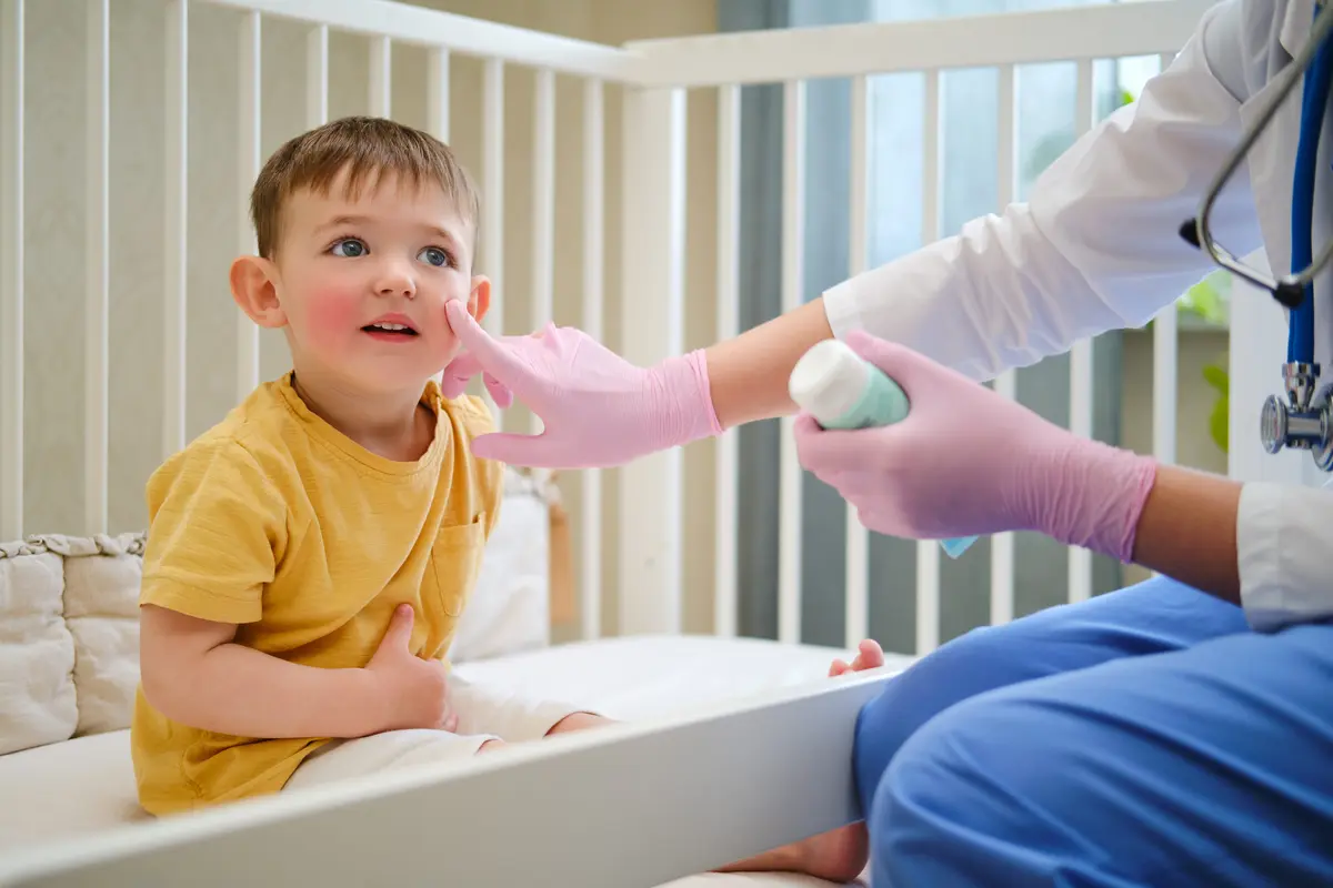 Eczema la copii: Ghid practic pentru părinți și soluții de gestionare