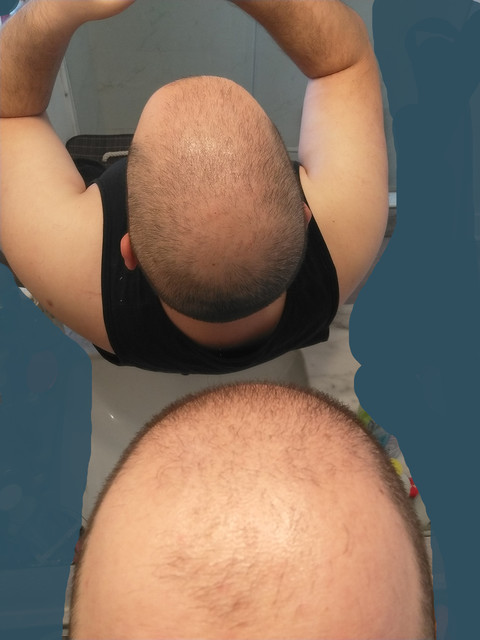 Hair-Line08262022c