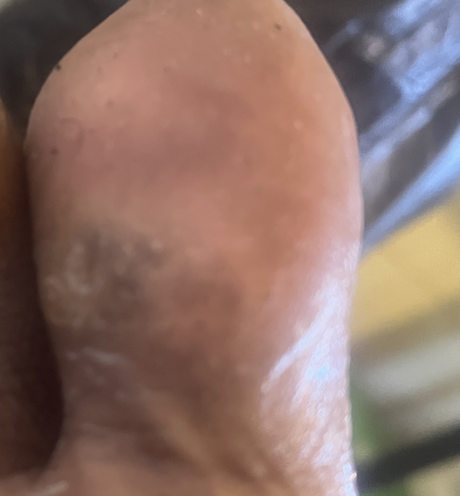 Discoloration under toes(pictures involved) podiatrist says it’s ...