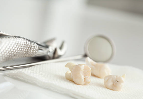 Wisdom Teeth Removal Sydney Wisdom-Teeth-Removal-Sydney