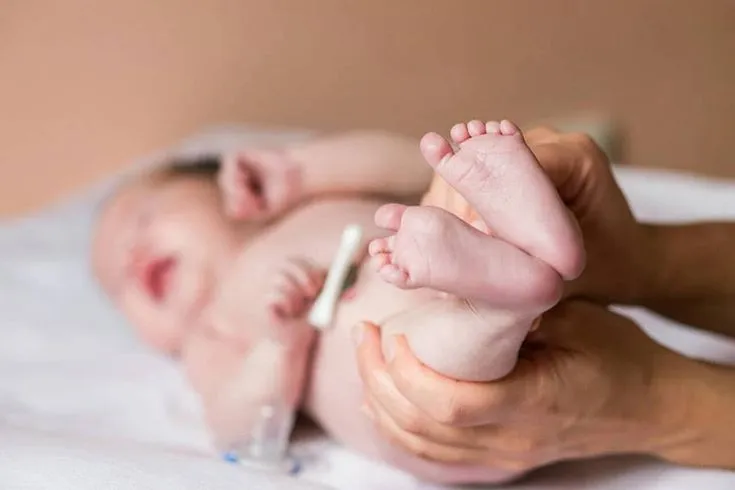 علاج مغص الرضع والغازات